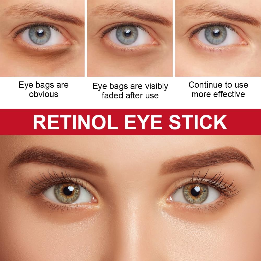 Retinol Eye Stick With Collagen,Hyaluronic Acid For Dark Circle, Wrinkles,Visible Results in 3-4 Weeks,Anti Aging Under Eye Cream, Retinol Eye Cream For Puffiness and Bags Reduces Fine Lines