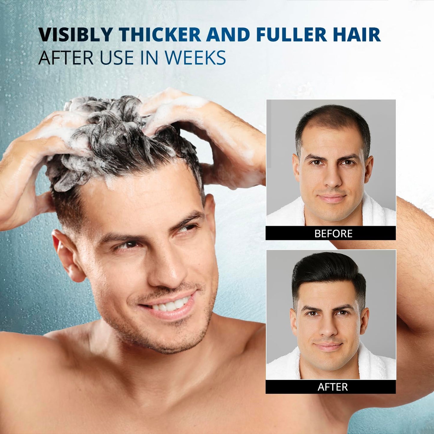 Root Activator Shampoo for Men: Made In USA Hair Growth Shampoo for Hair Loss and Thinning Hair - Hair Loss RegrowthTreatments for Women Men (10.1 Fl Oz (Pack of 1))