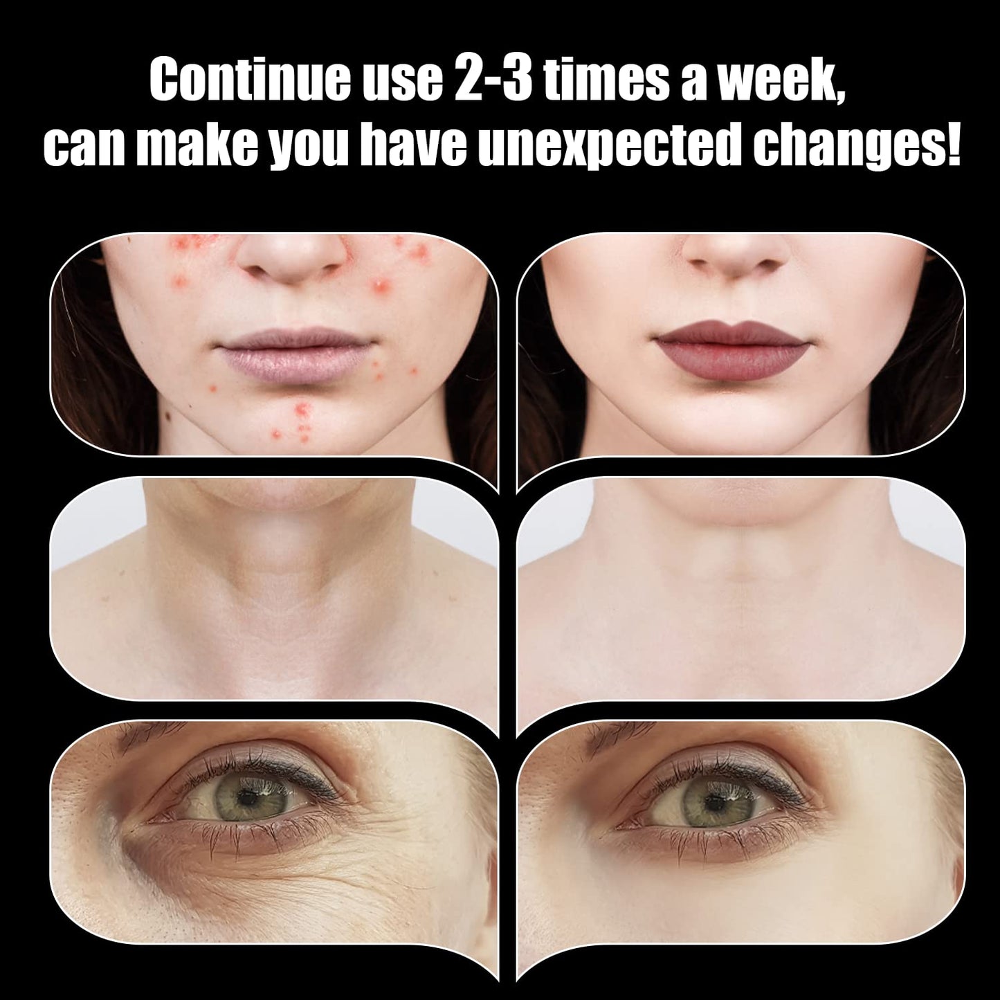 High Frequency Facial Wand - UUPAS Portable High Frequency Facial Machine with 6 Pcs Different Tubes(Orange & Purple)