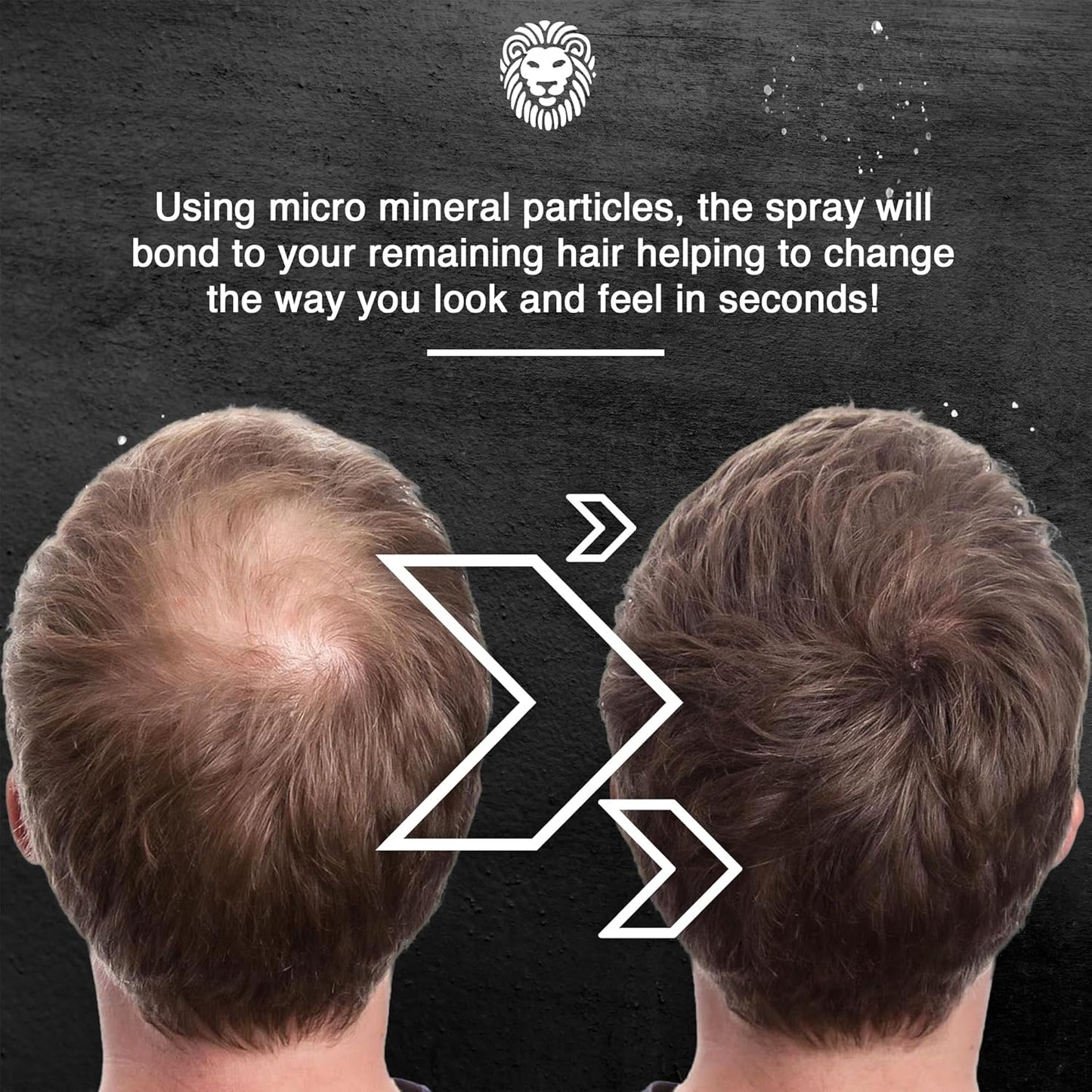 Mane Hair Thickening Spray & Root Touch Up, Instantly Thicker Hair for Men & Women, Fill in Hairlines and Hide Thinning and Fine Patches - Medium Brown, 12 Colors (6.76 oz)