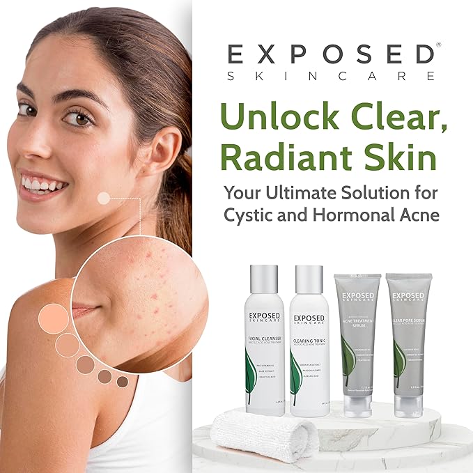Exposed Skin Care Basic Acne Treatment Kit - Includes Salicylic Acid Face Wash, Clearing Tonic, Treatment Serum with Benzoyl Peroxide, Clear Pore Serum - Natural Acne Solution for All Skin Types