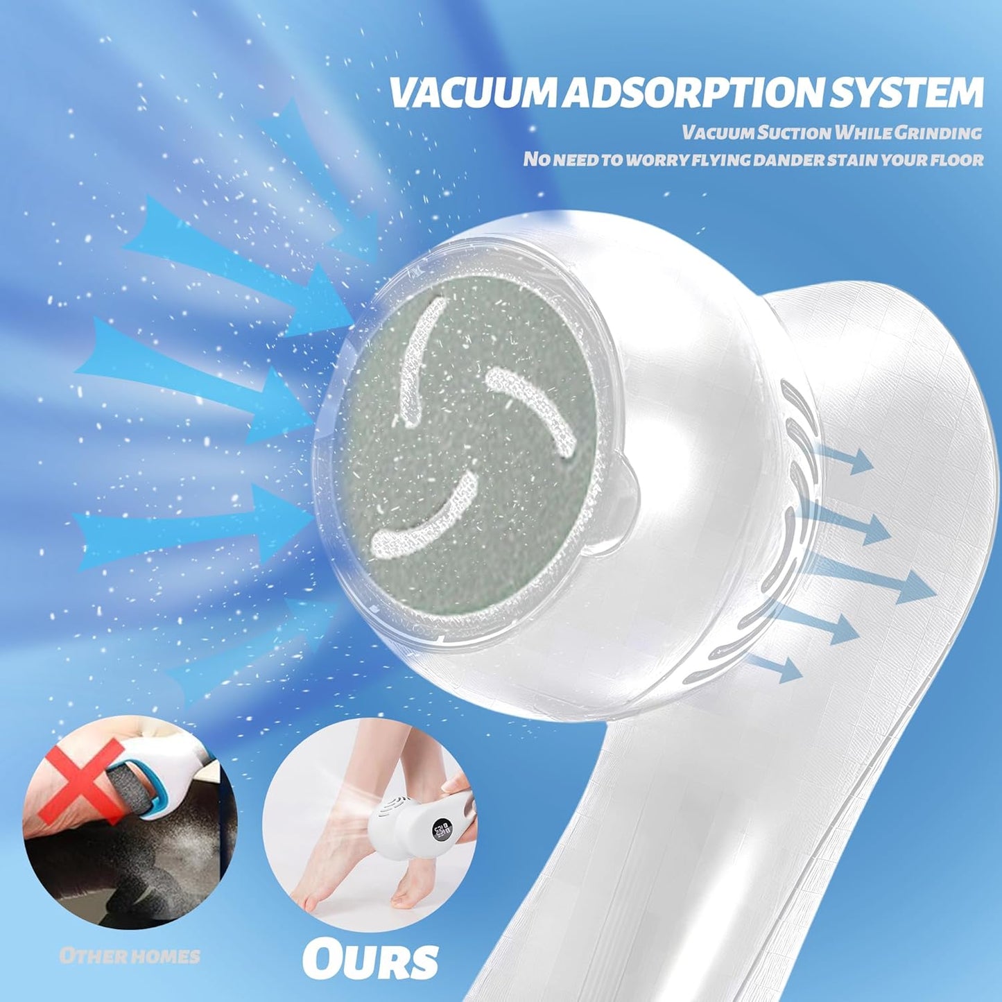 Electric Feet Foot Callus Remover Equipped with A Vacuum System Foot Scrubber 17 in 1 Professional Foot Care Tool Ipx6 Waterproof Rating for Removing Hard Cracks Dryness and Dead Skin (White)