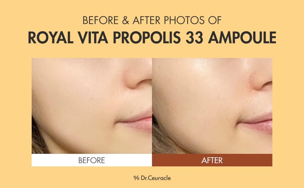 Dr.Ceuracle Royal Vita Propolis 33 Ampoule (30ml / 1.01 fl. oz.) - Ultimate Glow and Nourish Vitamin Serum for Radiant Skin, Formulated with Propolis and Royal Jelly Extract