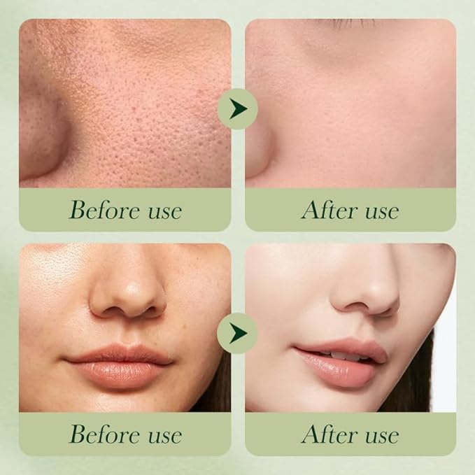 Avocado Skincare Sets, 6Pcs Skincare Gift Set with Facial Cleanser, Face Serum, Face Cream, Eye Cream, Toner, moisturizing Lotion, Anti Aging Skin Care Sets & Kits, Hydrating Facial Kit for women