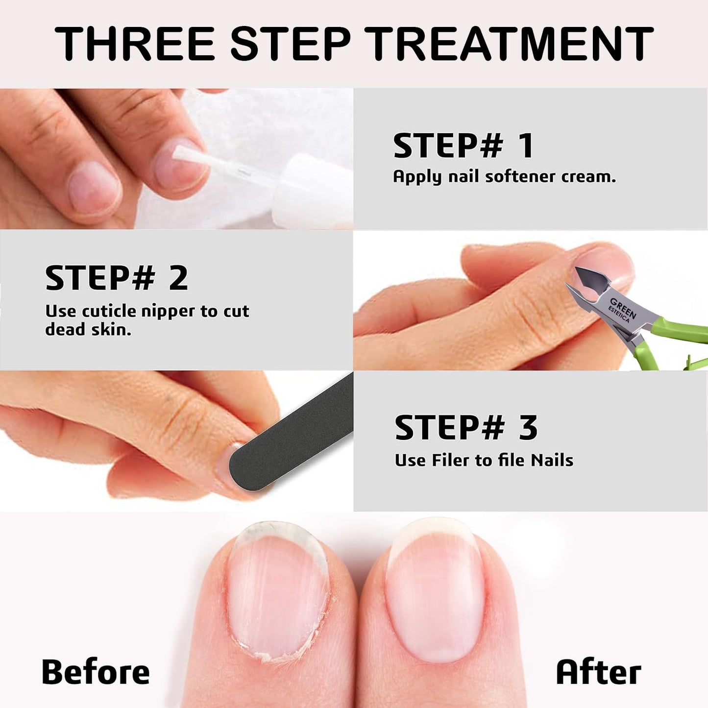 Professional Cuticle Trimmer Nail Cuticle Cutter Stainless Steel Cuticle Nippers with Sharp Blades of Cuticle Remover Clippers Manicure Tools Double Spring for Nail Care Pedicure Nail Tools (Multi)