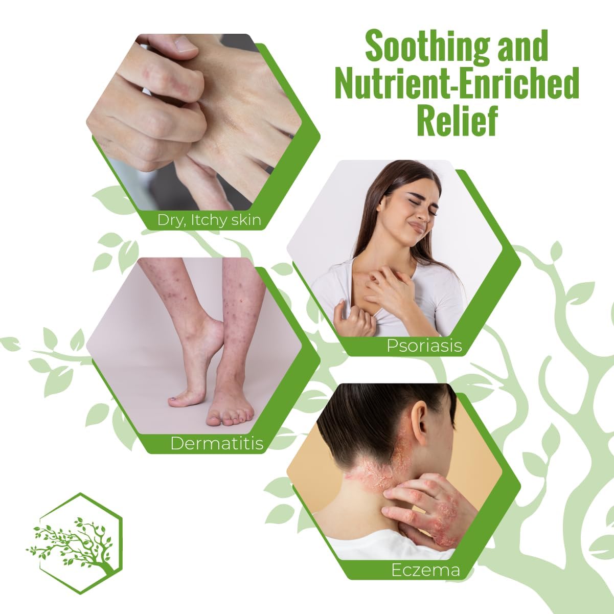 Wild Naturals Moisturizing Eczema Body Wash – Gentle Psoriasis Body Wash for Itchy, Dry Skin Relief – Eczema Soap for Redness and Flareups – Hydrating Cleanser for Women and Men