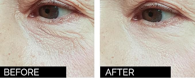 Anti-age under eye masks - With Hyaluronic Acid, Collagen & Vitamin C. Natural gel eye masks, under eye gel patches for dark circles & puffy eyes. Anti wrinkle skincare, hydrating & soothing. 20 pairs