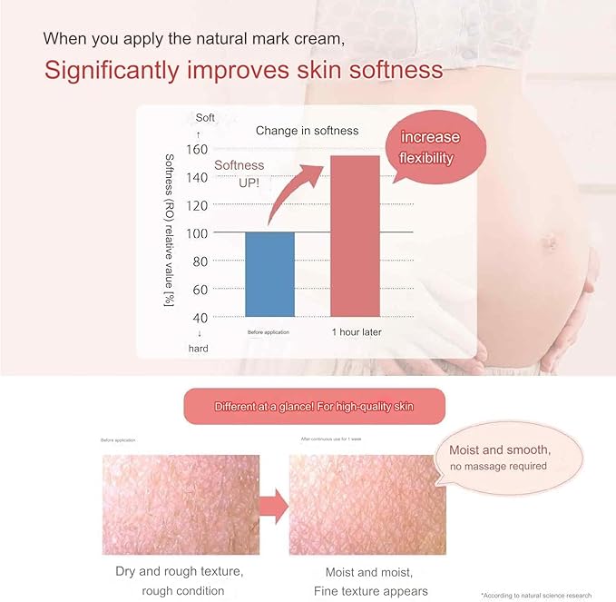 Mama & Kids Natural Cream/Stretch Mark Cream 150g japanese