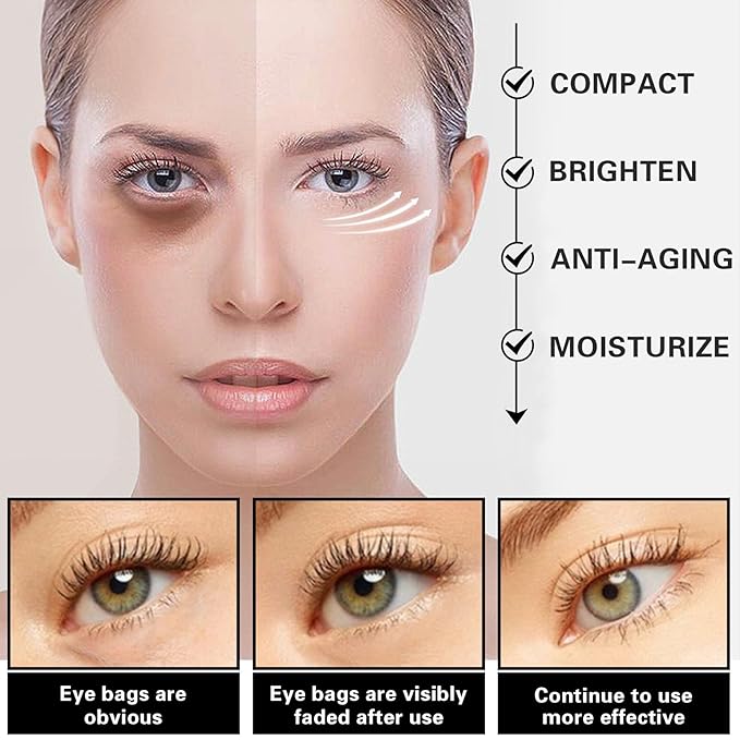 Eye Cream for Dark Circles Bags Eye Cream Eye Products Under Eye Bags Dark Circles