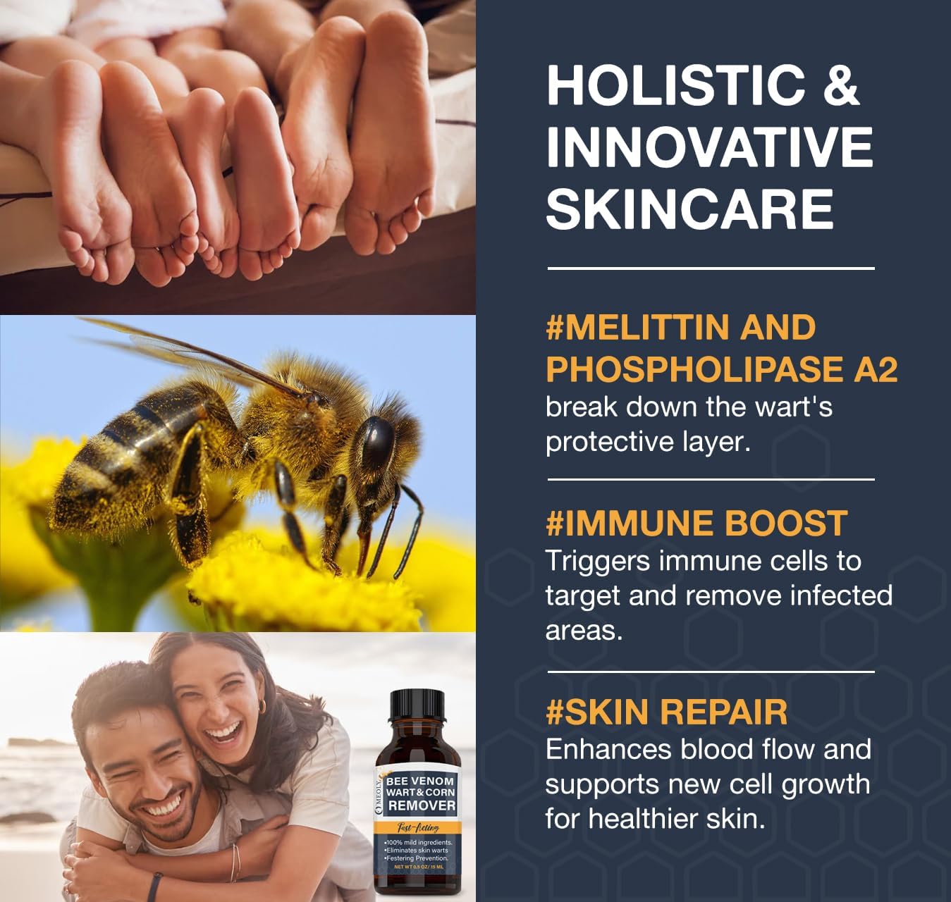 Bee Venom Skin Wart Remover: Fast-Acting 20% salicylic Acid Skin Wart Remover for Plantar Wart, Genital Wart