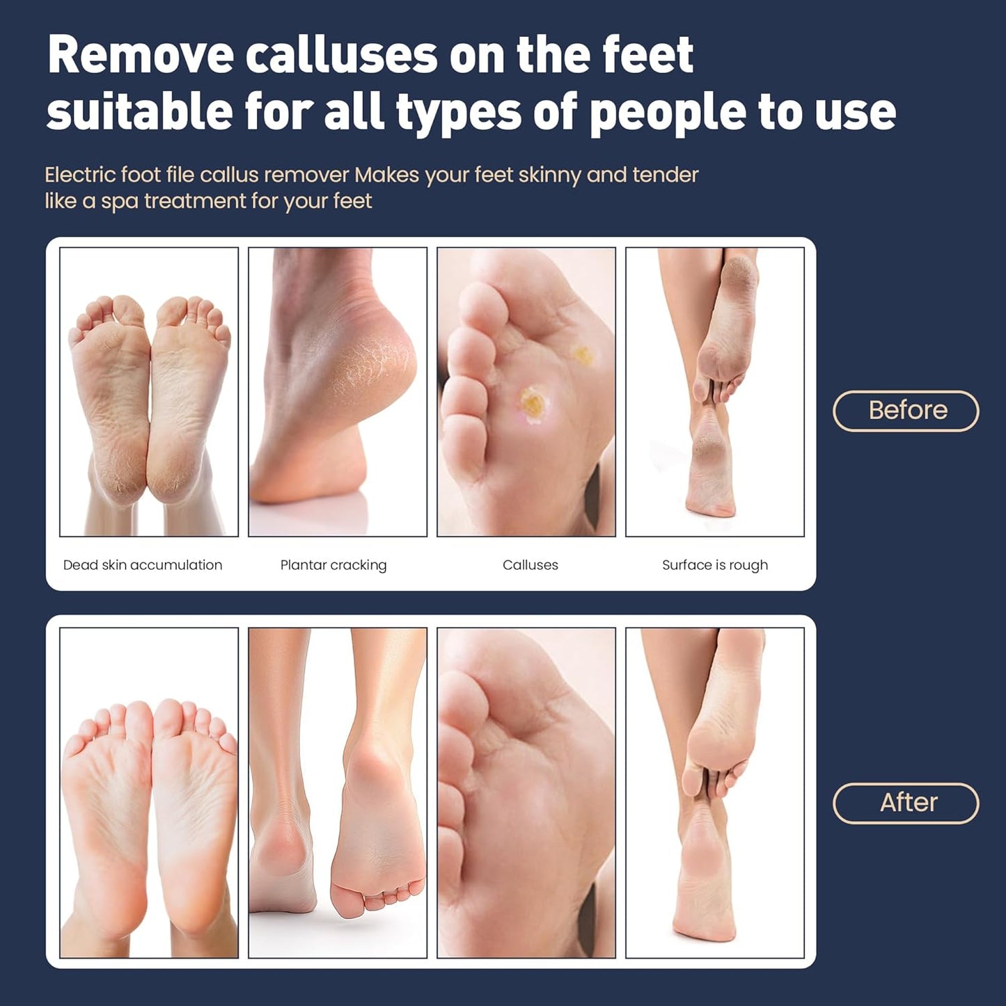 Electric Foot Callus Remover,2 in1 Rechargeable Callus Remover for Feet,9-Speed Wireless Electric Foot File Nail Grinder,Foot Scrubber Pedicure Tools for Dead Skin Dry Cracked Feet(Fold Gold)