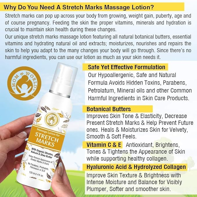 Mom & World Massage Lotion For Stretch Marks -120ml - With Organic Olivates, Kokum & Shea Butter