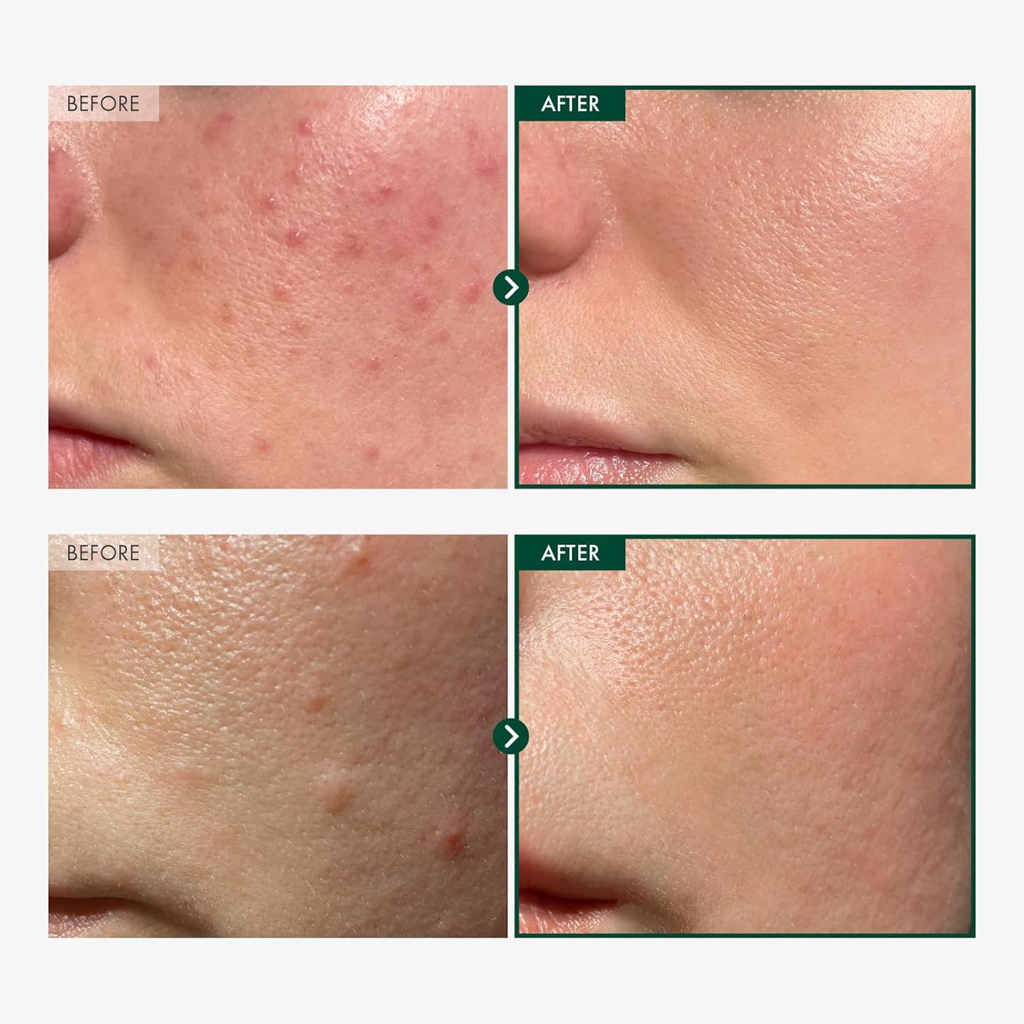 Madagascar Centella 86% Ampoule with 860,048ppm Centella Asiatica, Soothing, Calming, Facial Serum for face, for All Skin Types, Korean Skin Care, 100ml, 3.38 fl.oz.