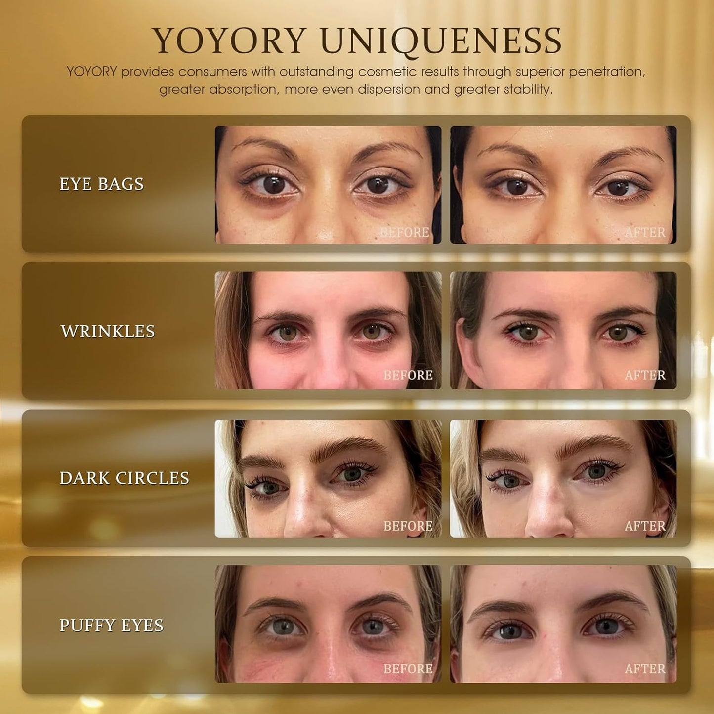 Under Eye Patches Masks - 24K Gold Eye Patch for Dark Circles & Puffy Eyesg,Fine Lines,Eye Bags Collagen Infused with Hyaluronic Acid Wrinkle Smoothing, Hydration & Firming Care (30 Pairs) Gold