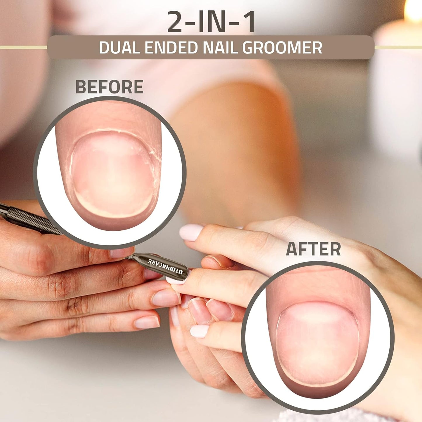 Utopia Care Cuticle Pusher Tool & Spoon Nail Cleaner, Professional Stainless Steel Cuticle Remover & Cutter, Durable Manicure & Pedicure Tool for Finger & Toenails, Bronze