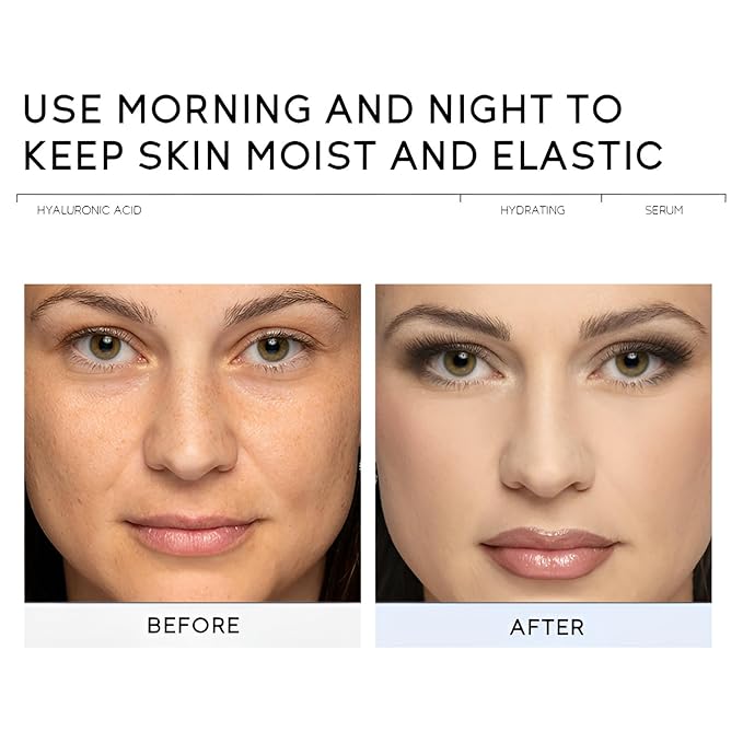 Hyaluronic Acid Serum for Face, Hydrating Face Serum for Dry Skin W/Hymagic-4D, Squalane, Vitamin C & E for Plumping, Hydrating & Anti-Aging Serum, Skin Care, 1.06fl.oz, Pack of 2