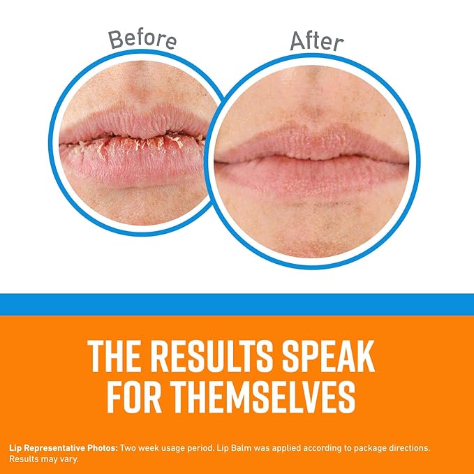 O'Keeffe's Cooling Relief Lip Repair Lip Balm for Dry, Cracked Lips, Stick, (Pack of 3)