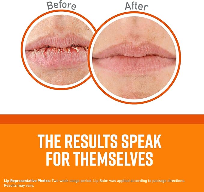 O'Keeffe's Unscented Lip Repair Lip Balm for Dry, Cracked Lips, Stick, (Pack of 1)