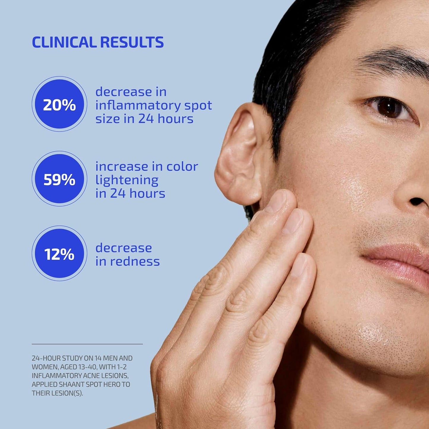 Codex Labs Shaant Spot Hero – Sulfur & Green Tea Gel for Blemish-Prone Skin | Fast-Drying Formula for Clear-Looking Skin | 0.5oz