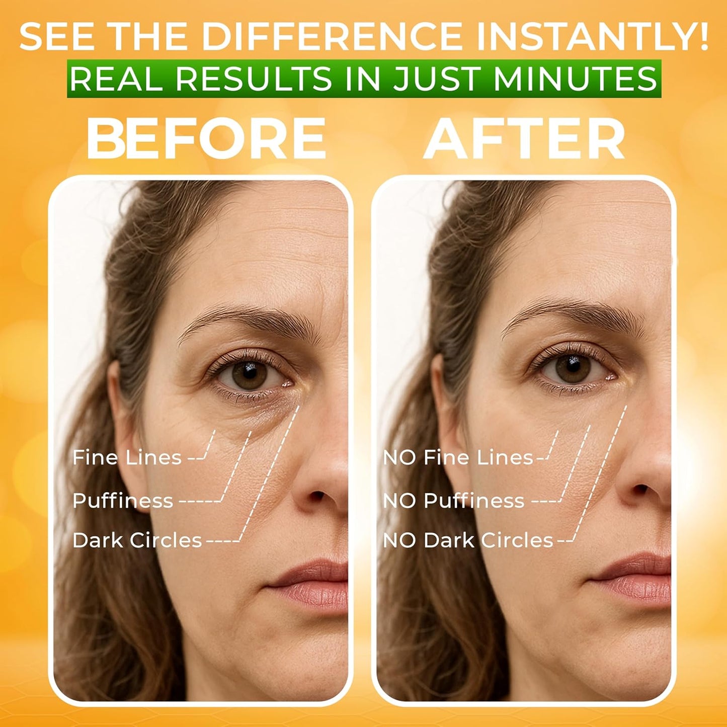 Puffy Eye Treatment Instant results – Naturally Eliminate Wrinkles, Puffiness, Dark Circle and Bags in Minutes – Hydrating Eye Cream w/ Green Tea Extract, Dead Sea Minerals by SEAMANTIKA – .8 fl.oz.