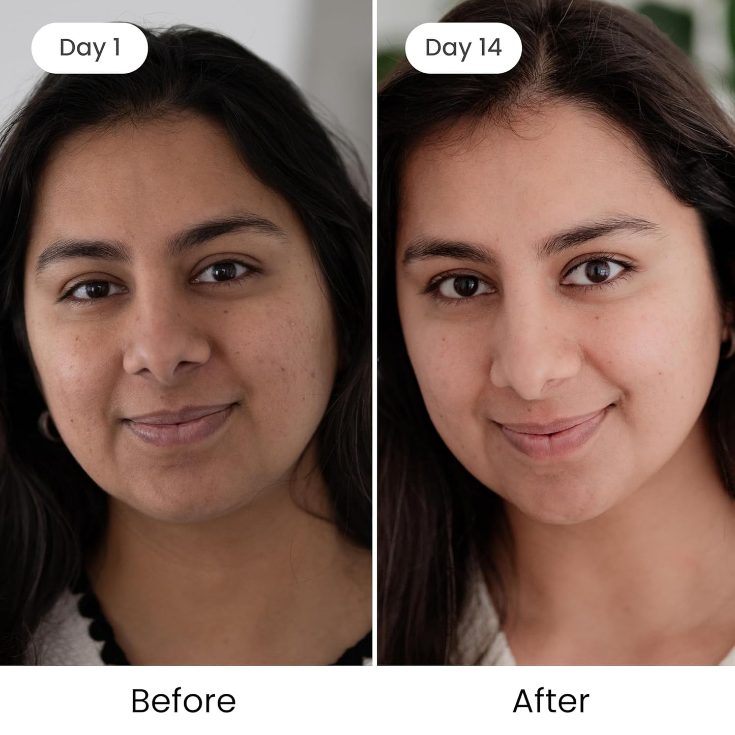 Shankara Kumkumadi Oil with Pure Saffron and Ayurvedic Herbs (Rose Aroma 18ml)