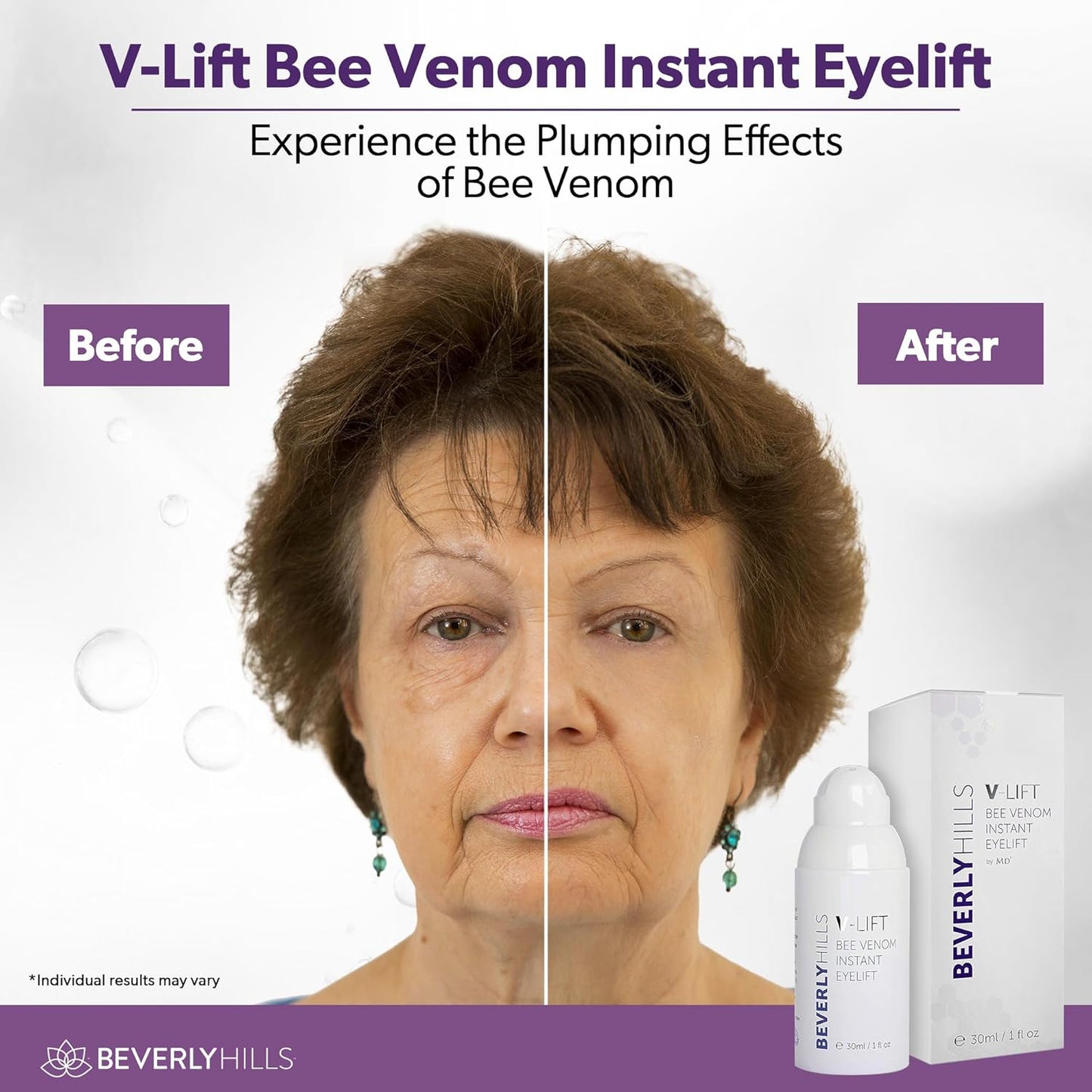 Beverly Hills V-Lift Instant Eye Lift and Eye Tuck Bee Venom Serum for Puffy Eyes, Dark Circles, Wrinkles, and Under Eye Bags Treatment for Women and Men | 30mL (120 Day Supply)