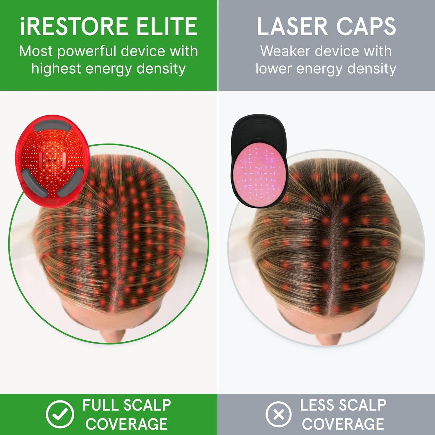 iRestore Elite + Rechargeable Battery Pack - Laser Red Light Therapy for Hair Growth - FDA Cleared Hair Loss, Hair Thinning Treatment for Men & Women - Hair Regrowth Laser Cap - 500 Lasers & LEDs