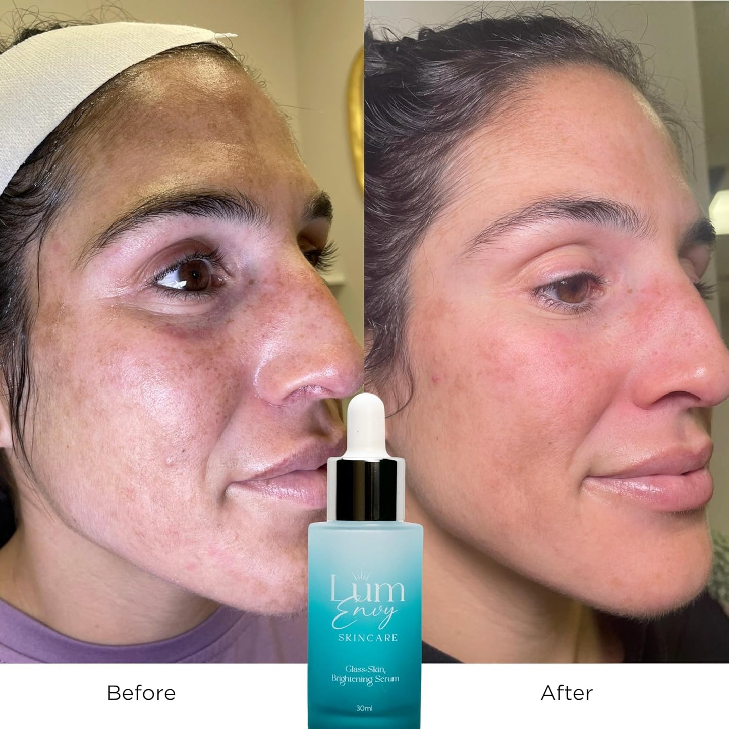 Salmon DNA Glass Skin Serum - Hydrating Korean Skincare Face Serum with PDRN, Niacinamide & Centella Asiatica | Brightening, Dry Skin, Anti-Aging, Dark Spots & Wrinkles | 30ml