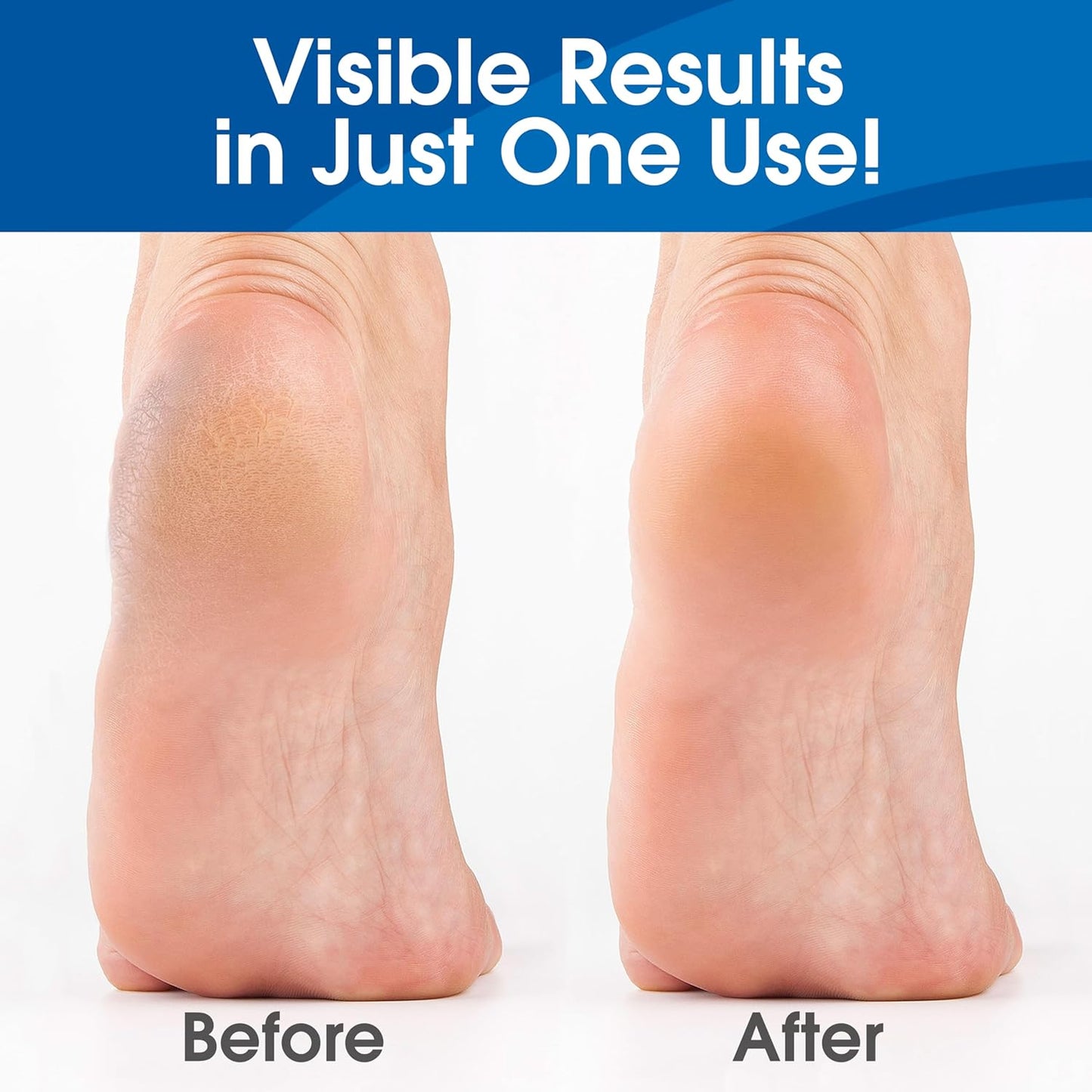 DeEnti Callus Remover for Feet, Extra Strength Foot Callus Remover Gel, 8oz Salon Grade Home Pedicure Supplies for Dry Skin, Cracked Heel, Professional Strength Foot Care, Unscented