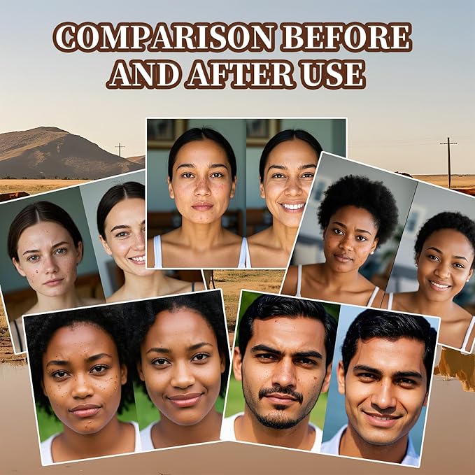 Beef Tallow for Skin, Tallow and Honey Balm, Facial Moisturizer Cream, 100% Organic Grass Fed Whipped Beef Tallow Balm Deeply Moisturizing for Face & Body, Suitable For All Skin Types(3.53oz)